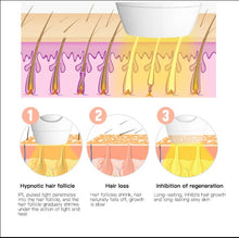 Load image into Gallery viewer, IPL Laser Hair Removal - Black